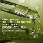 Rivaj UK Acne Treatment Serum 30ml